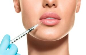 What is permanent lip augmentation?